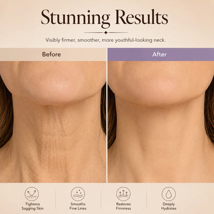 Fablo NECKLIFT™  Tighten & Lift Neck Cream